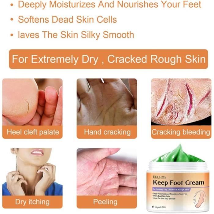 O'Keeffe's Healthy Feet Exfoliating Foot Cream for Extremely Dry, Cracked  Feet, 3 Ounce Tube, (Pack