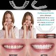 Blanchiment Snap parfait sourire prothèse dentaire confort dents réutilisables couverture blanchiment réglable fausses dents con-0
