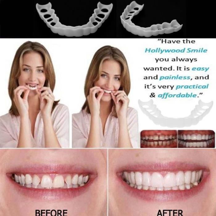 Blanchiment Snap parfait sourire prothèse dentaire confort dents réutilisables couverture blanchiment réglable fausses dents con