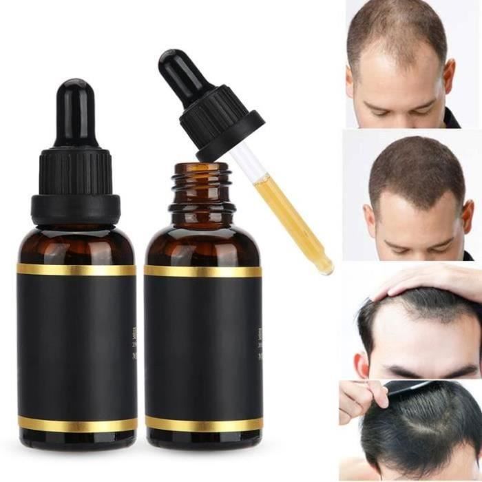 Huile de croissance des cheveux - ATYHAO - Ricin - 3 pièces - 30 ml