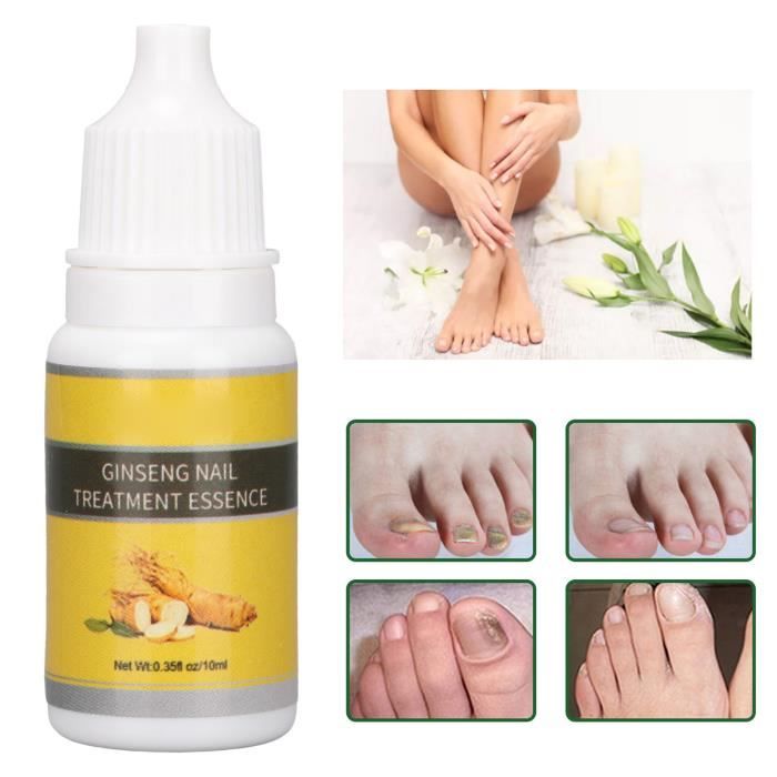 Réparation des ongles Nail Repair Huile Essentielle Soin Traitement