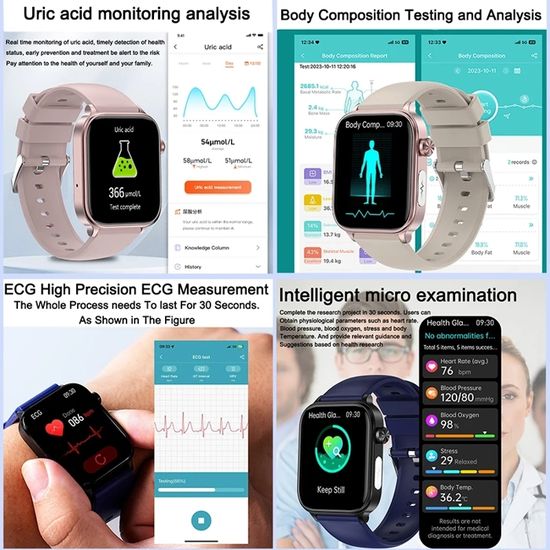 Montre Intelligente Mijia-Xiaomi – ECG+PPG, étanche, Bracelet Acier Inoxydable 41mm