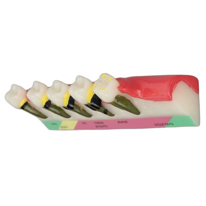 Lot De 32 Pièces De Dents De Rechange Pour Modèle Dentaire KaVo Basic - Typodont - Neuf