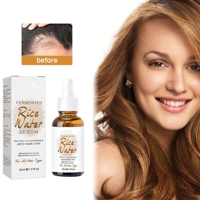 Sérum Anti-chute Et Croissance Cheveux MYTEX-SHOP - 30ml - Neuf - À Base De Gingembre