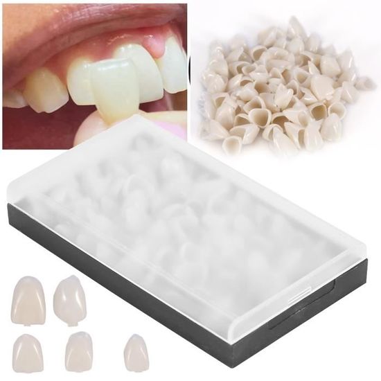 50 Pièces/Boîte Couronne Temporaire Dentaire pour Dents Antérieures,  Couronnes Dentaires Temporaires pour Dents en Porcelaine, Couronne Molaire