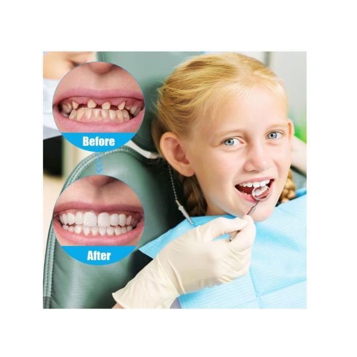 2 Paires Faux Dentier Sourire Parfait, Dent Provisoire Fausse Dent Dentier  Amovible Haut et Bas, Facette Prothese Dentaire, Fausses - Cdiscount Au  quotidien