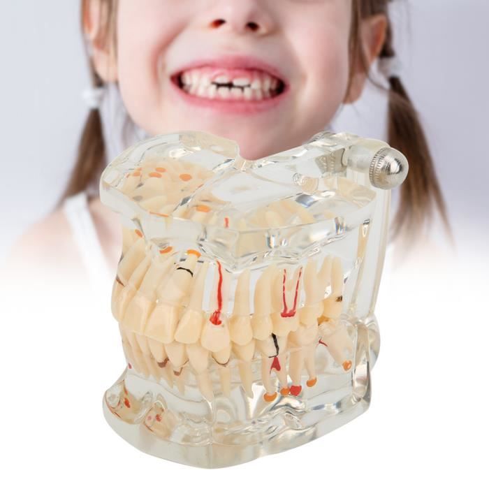 Modèle Dentaire Typodont Pour étudiants Et Professionnels - Pratique Implants, Orthodontie