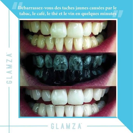 Poudre De Charbon Blanchissante 15g Glamza Blanchiment Dentaire Au Charbon Actif A Base Vegetal Charbon Vegetal Dent Blanche Achat Vente Soin Blanchiment Dents Poudre Glamza Cdiscount
