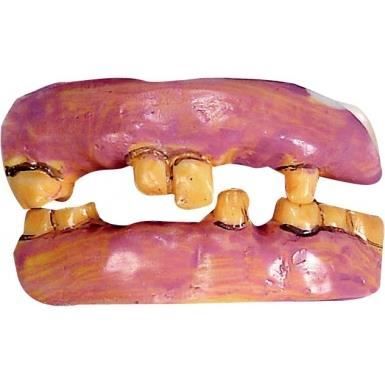 Dentier vieilles dents