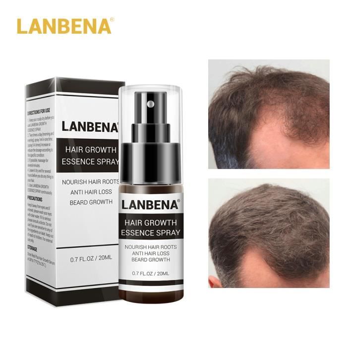 LANBENA Spray rapide et puissant pour le soin des cheveux pour hommes et femmes Spray anti-chute