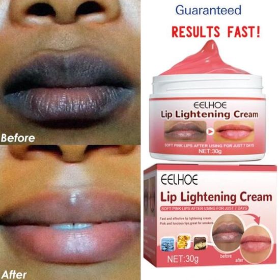Baume/ Crème éclaircissante Rose Pour Lèvres Foncées - SPF15 - Naturel - Valide 04/2027