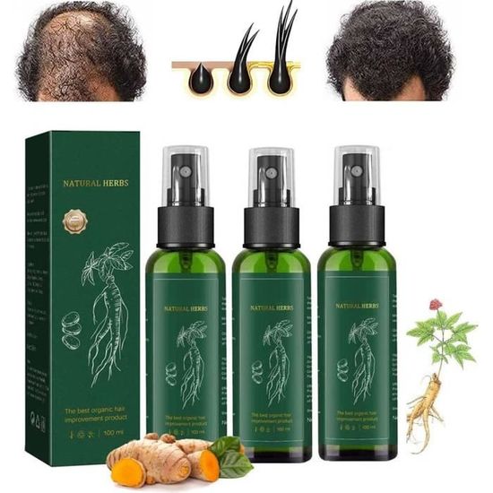 Kortin Red Ginseng Hair Regeneration Spray,Ginseng Hair Regrowth Serum