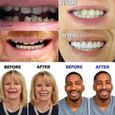 Fausse Dents Haut et Bas Prothese Dentaire Amovible Haut et Bas Dentier pour Inférieure et Supérieure Réparez rapidement vos d 8f926-3