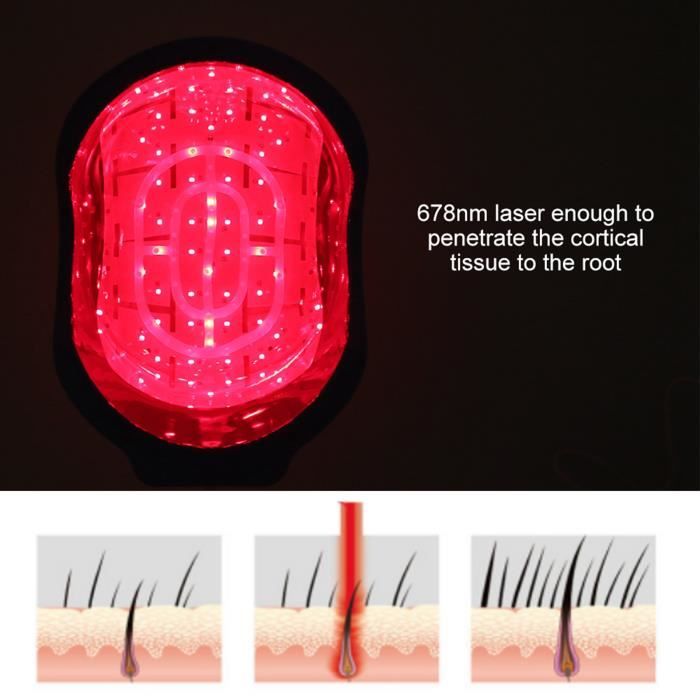 Casquette LED anti-chute cheveux ; une découverte de la recherche