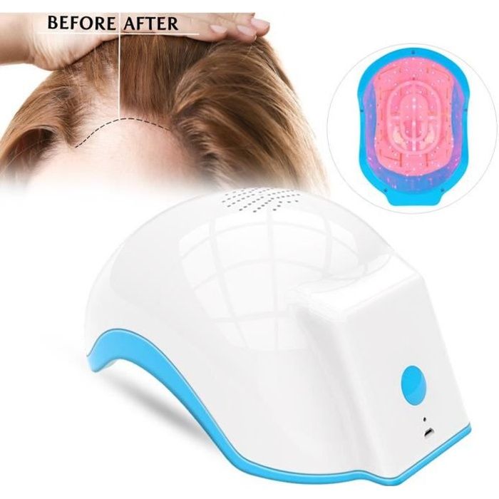 Casque de repousse des cheveux traitement de chute de cheveux 100-240v EU Plug----Timequare