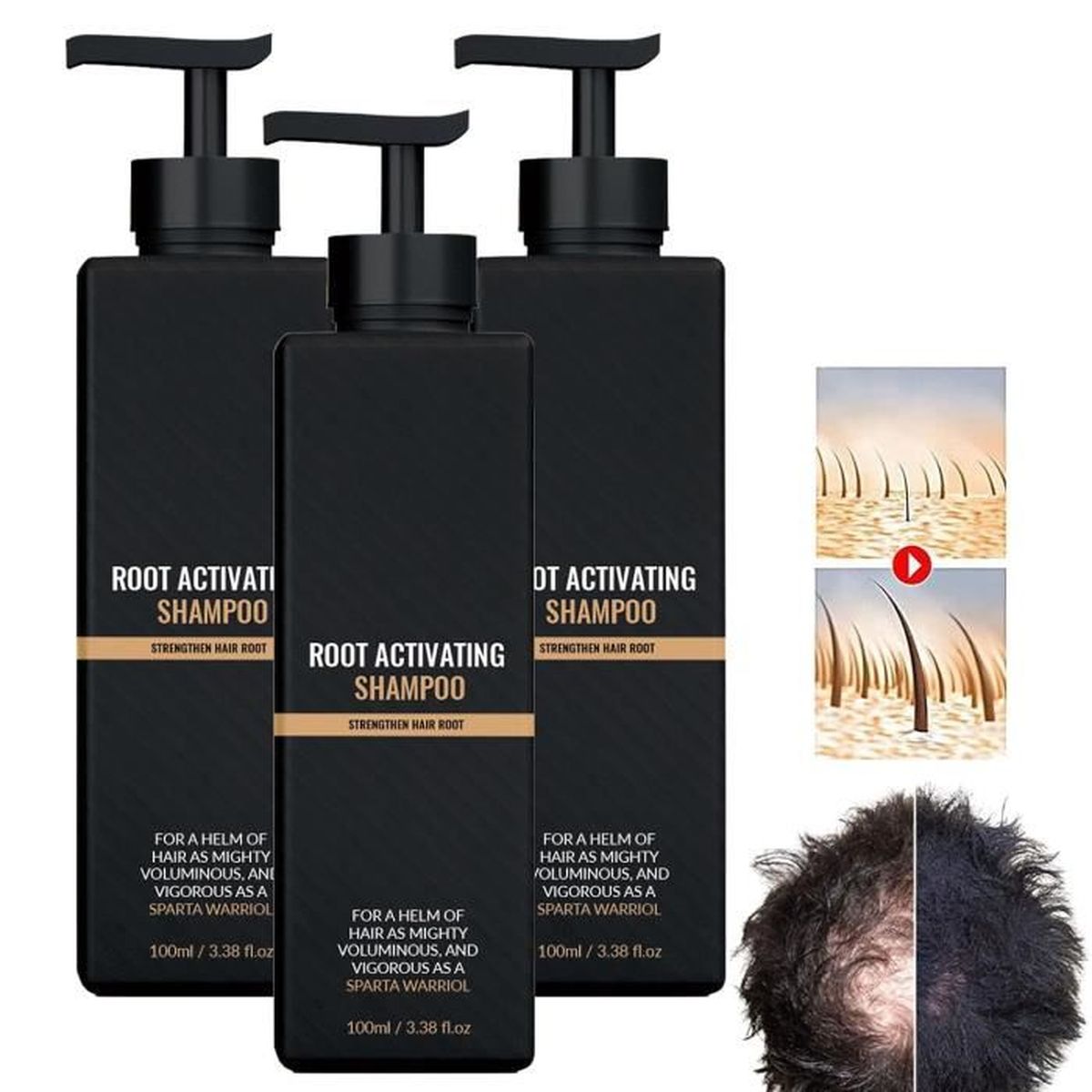 Root Activator Shampoo, Hair Loss Shampoo, Shampoo Root Activator