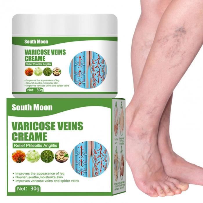 30g Crème,Crème apaisante pour Les Jambes,Améliorer la Circulation Sanguine,éliminer Les et Les