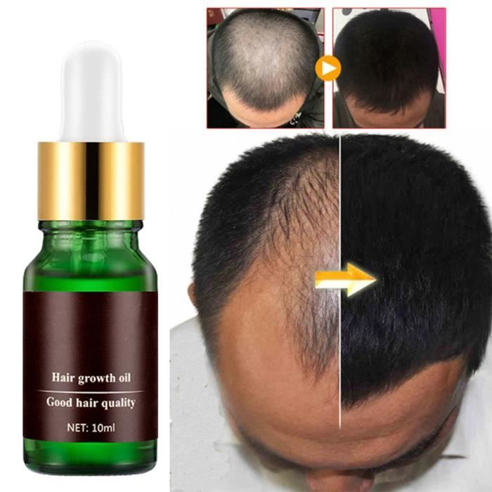 Huile De Croissance Nature Sure Pour Cheveux - 100ml - Prévention Chute Et Soin Naturel