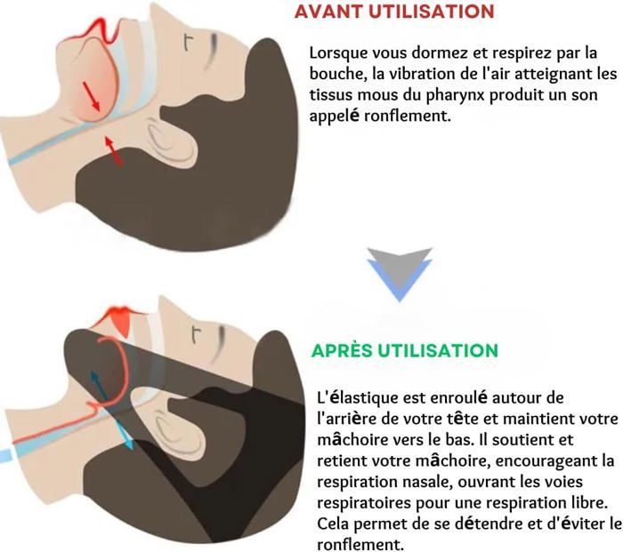 orth-se-anti-ronflement-pour-l-apn-e-du-sommeil-care-sommeil