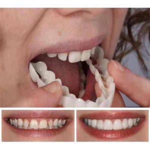 SOIN BLANCHIMENT DENTS 1 Paire Prothèses Cosmétiques de Facettes Dents Temporaires Haut et Bas Faux Dents Temporaires Prothèses Cosmétiques 98666