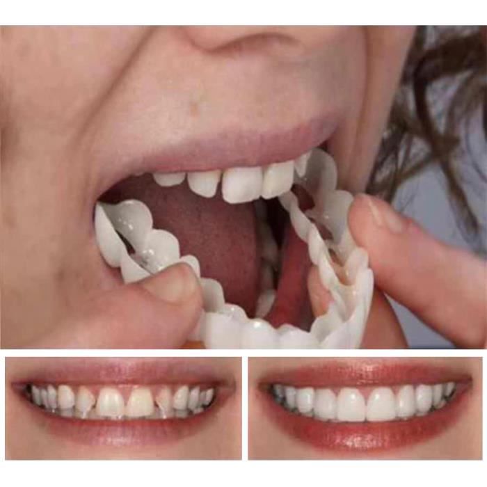 1 Paire Prothèses Cosmétiques de Facettes Dents Temporaires Haut et Bas Faux Dents Temporaires Prothèses Cosmétiques 98666