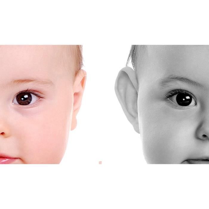 OTOSTICK - Correcteur cosmétique pour oreilles séparées - Pour les bébés -  8 pièces