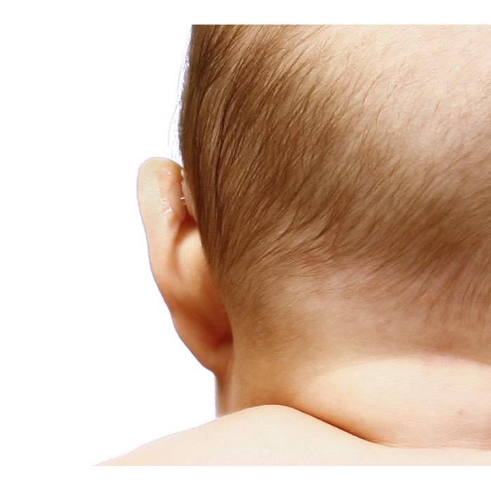 Otostick® Bébé correcteurs esthétiques pour oreilles décollées
