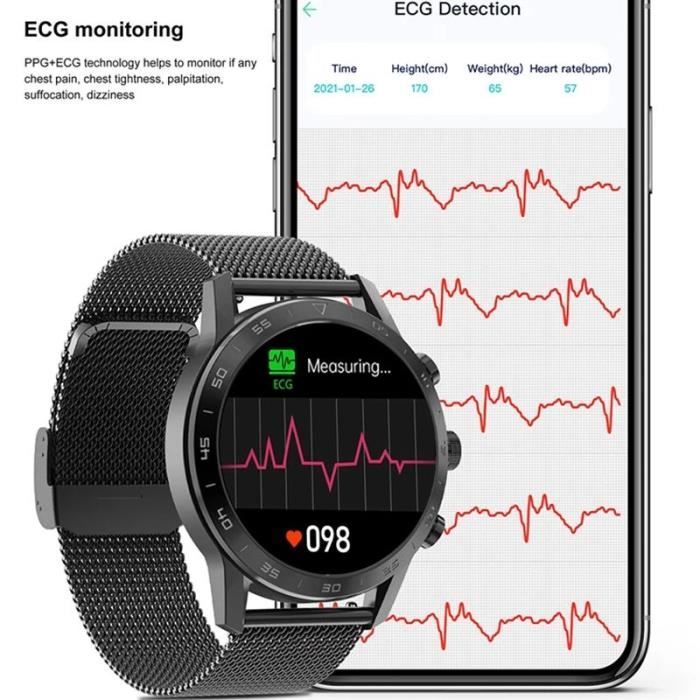 Montre ecg top xiaomi