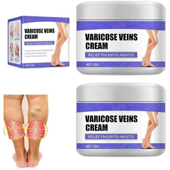 Crème pour les jambes antivarices Vein Care Traitement des varices — free download