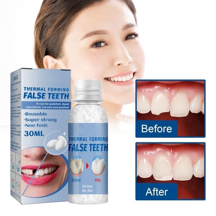 Temporaires remplacement fausses dents dentier provisoire de prothèses  dentaires