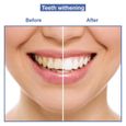 MEAWHITE • Kit Recharge 3 SERINGUES 10ml pour blanchiment des dents à domicile • 100% SANS peroxyde • Gel blanchissant dentaire-1