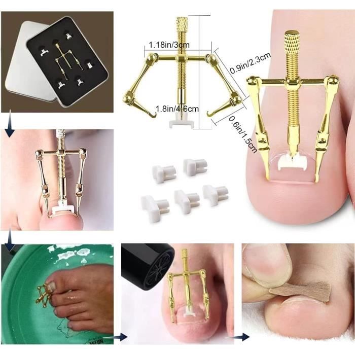 Kit De Soin Pour Ongles Incarnés – 7 Outils En Acier Inoxydable – Manche Anti-dérapant