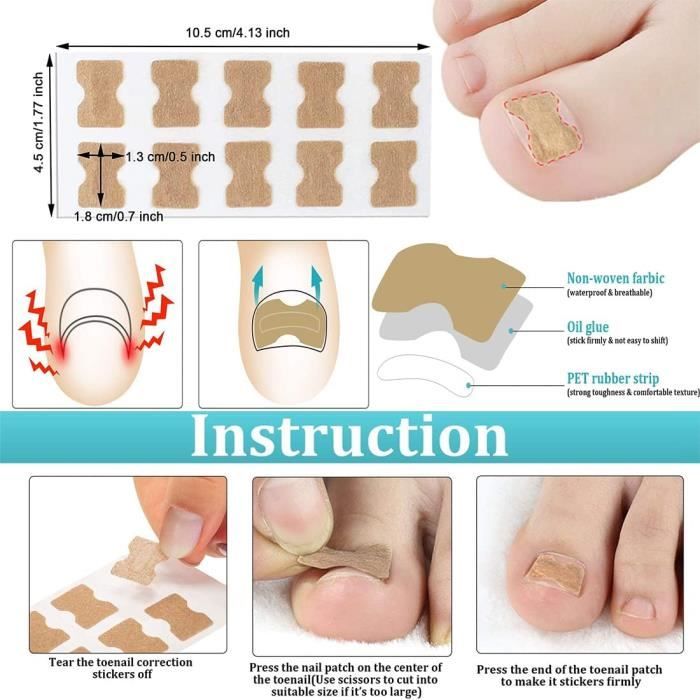 Lot De 2 Kits French Manucure MISS COP - Soin Des Ongles 6x12 Ml - PROMO