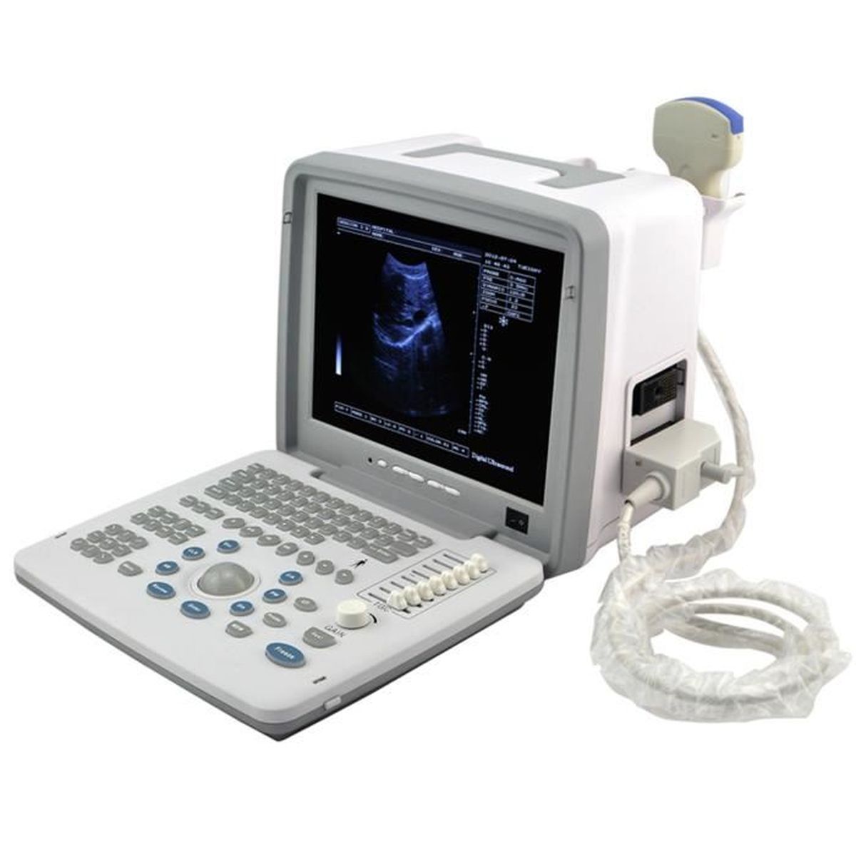 medical ultrasound scanner