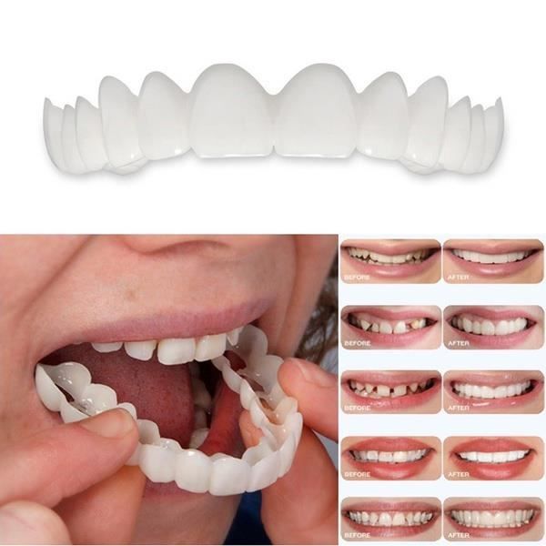 Prothèse Dentaire Temporaire En Silicone – Lot D’amélioration De Sourire – Ajustable – Confortable – Neuf Sous Sachet