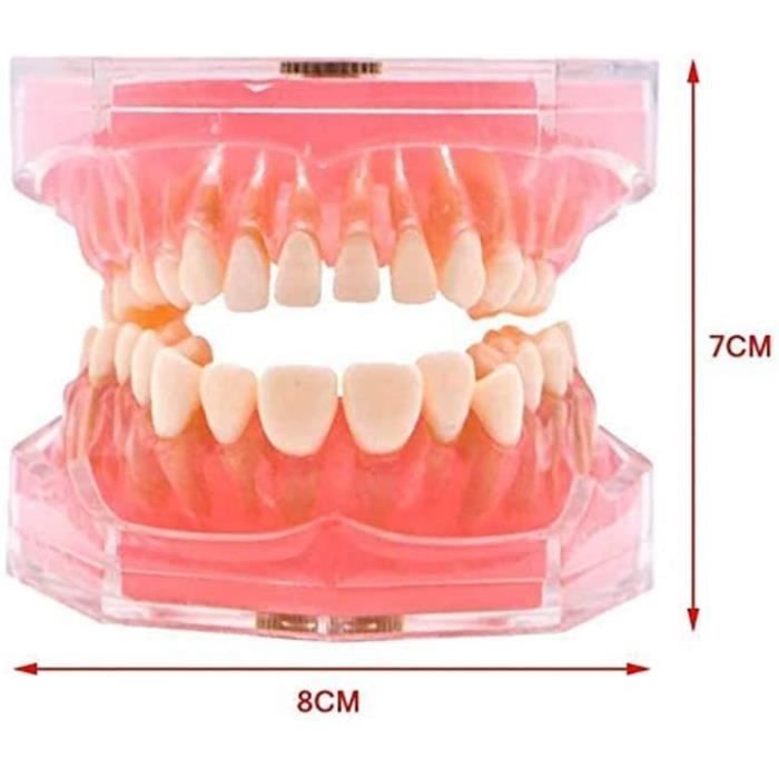 Vente de Modèle de dents d'enfants Modèle d'étude de démonstration en  pathologie pédiatrique 4002 en ligne 