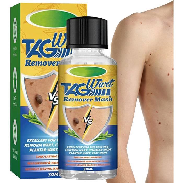 Crème Anti-verrues Et Acrochordons 20 Ml - Soin Corps Entier Aux Ingrédients Naturels