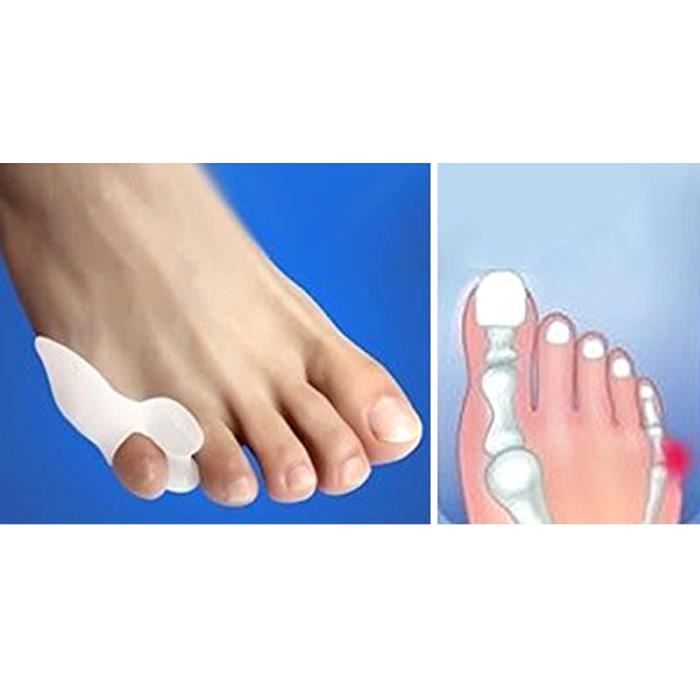 1 paire Séparateurs Correcteurs pour Hallux Valgus en Gel Protecteur pour Petit Orteil