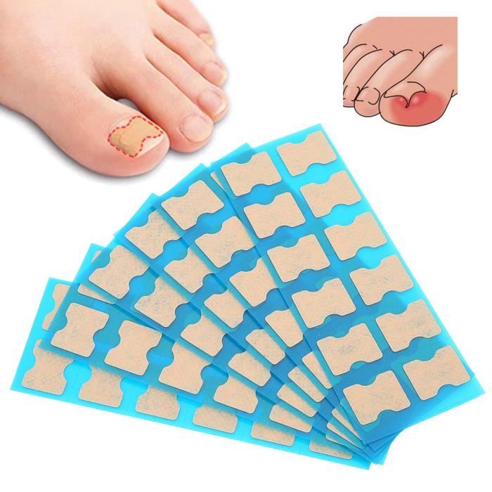 Qiilu Patch D Ongle Incarne Patch De Correction Des Ongles Incarnes Autocollant De Pedicure De Soins Des Pieds Outil De Cdiscount Electromenager Qiilu Patch D Ongle Incarne Patch De Correction Des Ongles Incarnes Autocollant De Pedicure De Soins Des Pieds Outil De Cdiscount Electromenager