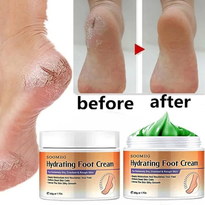 Baume creme pour talon craquele soin de la peau pour les mains et les pieds gerces secs et rugueux essence Cdiscount Au quotidien