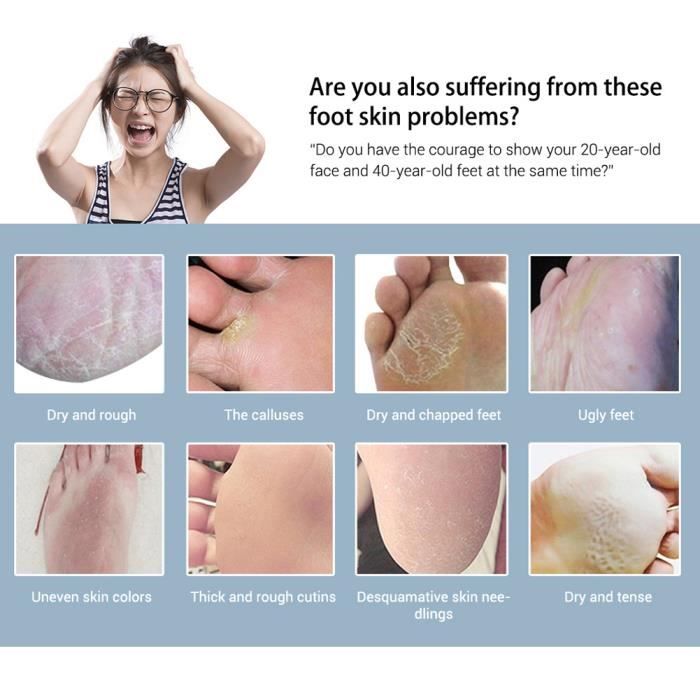 PELICAN Soap Foot Care Soap | Savon Exfoliant Pieds