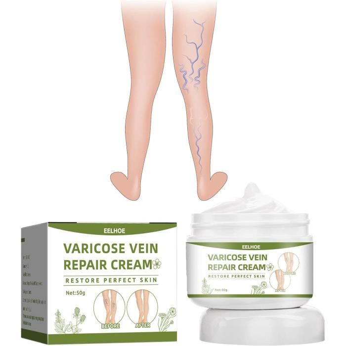 Crème Soin Des Jambes 50g Crème Varices Crème Contre Les Varicosités Crème Jambes Apaisantes
