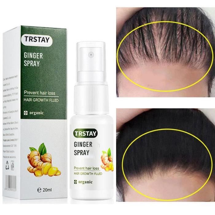 Huile Essentielle Pour Croissance Rapide Des Cheveux - Anti-chute, Calvitie, Alopécie - 30ml - Neuf