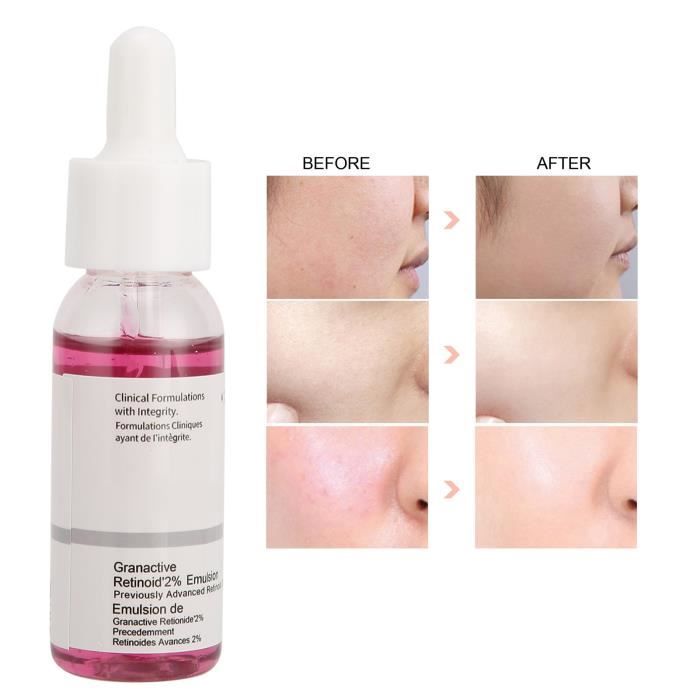 Sérum Concentré Acide Salicylique 2% & Zinc - Anti-imperfections 30ml