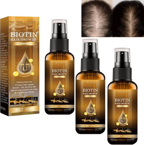 Shampooing Fortifiant à La Biotine Et Kératine Purc - 300ml, Sans Sulfates, Pour Croissance Rapide