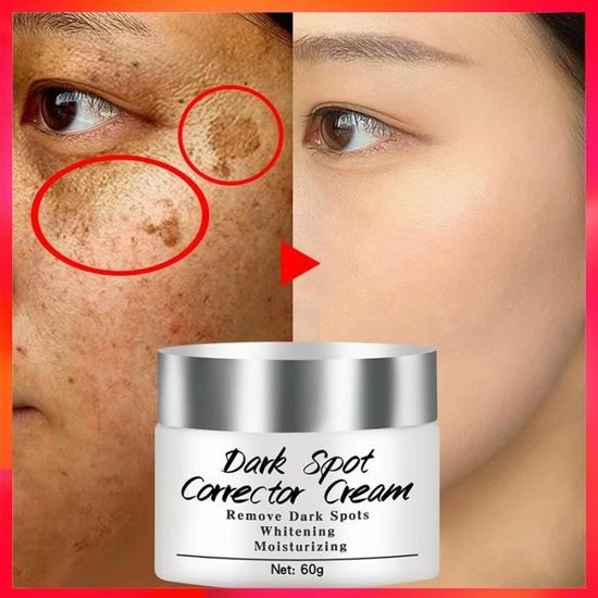 Givrelle Crème Eclaircissante Corps et Visage 30 ml - Redcare Pharmacie