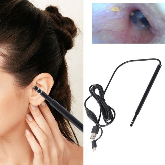 Otoscope Oreille, 1296P HD Kit Camera Oreille D'élimination Du Cérumen Avec 6 Lumières Led Otoscope Oreille, 1296P HD Kit Camera Oreille D'élimination Du Cérumen Avec 6 Lumières Led