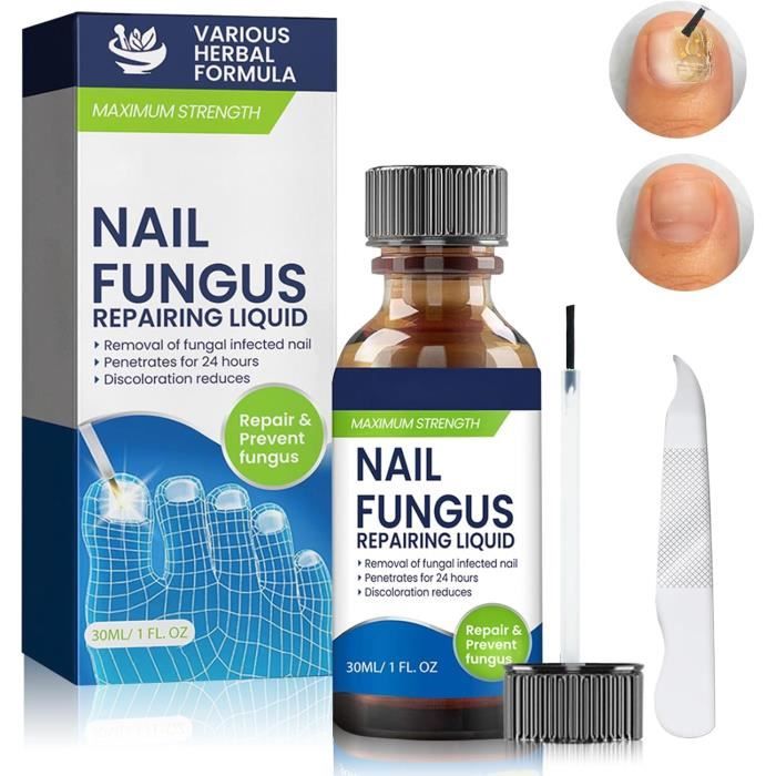 Soin Professionnel Pour Ongles 30ml - Traitement Mycose, Ongles Décolorés Et épais - Neuf