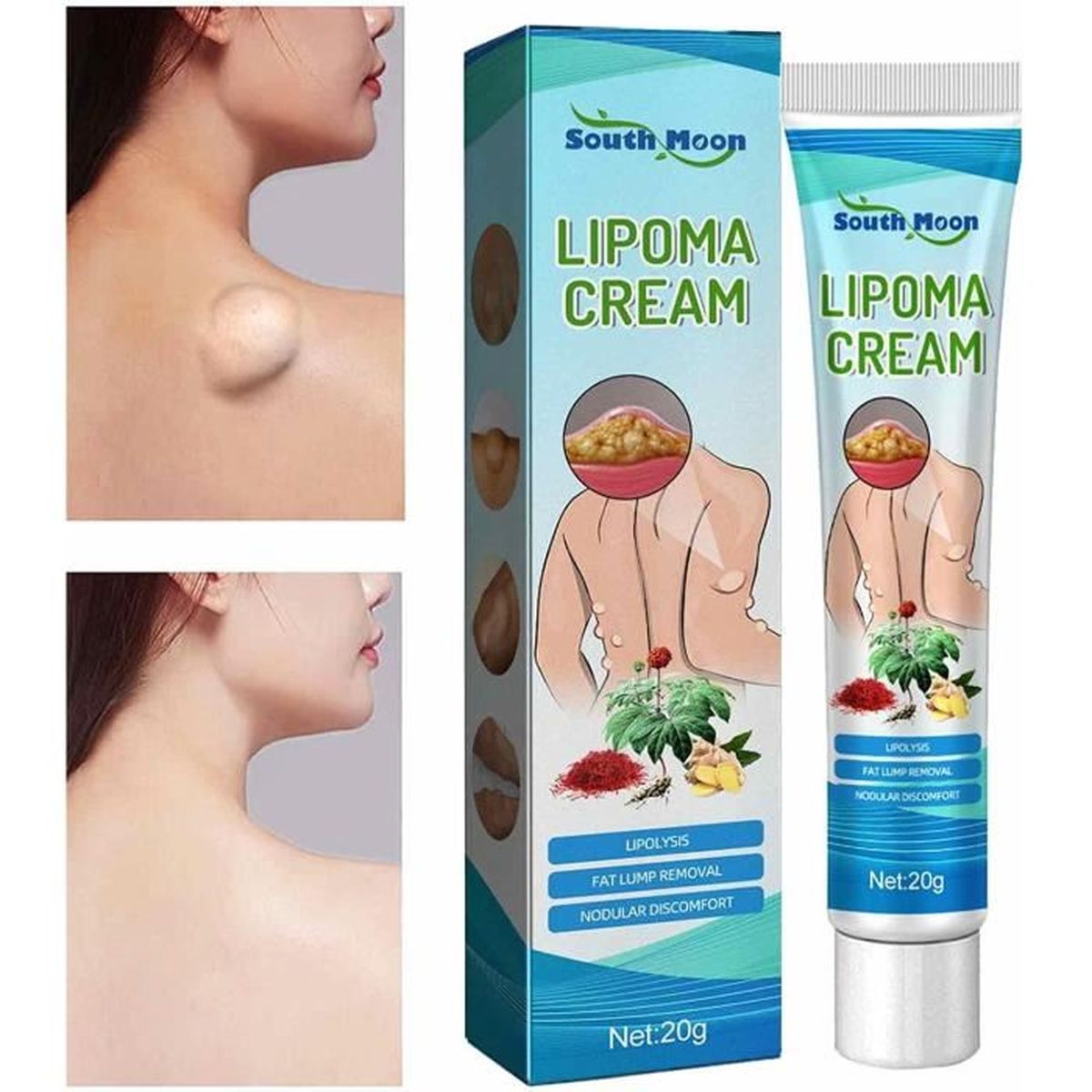Crème Lipomas Nettoyante Antibactérienne - Élimination Des Amas Graisseux - Produit Générique Neuf