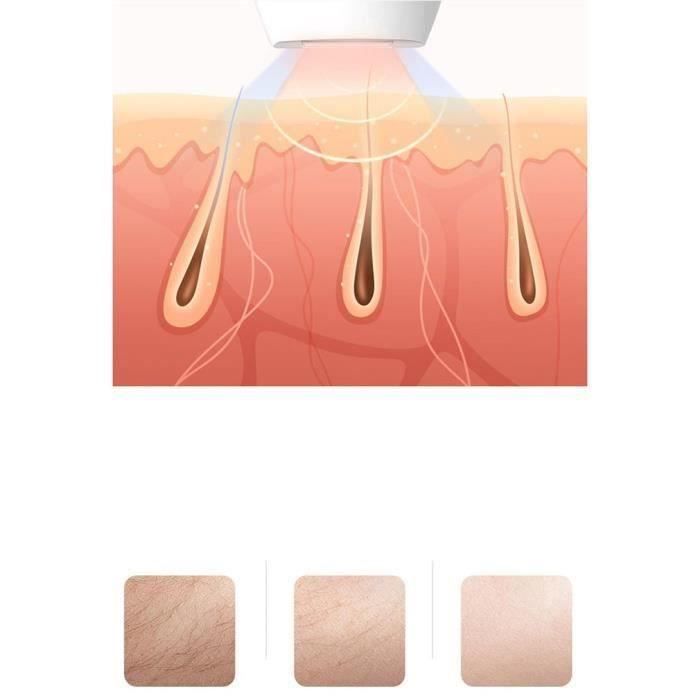 Mini Épilation faciale d 'épilation de dames d 'instrument d 'épilation de laser